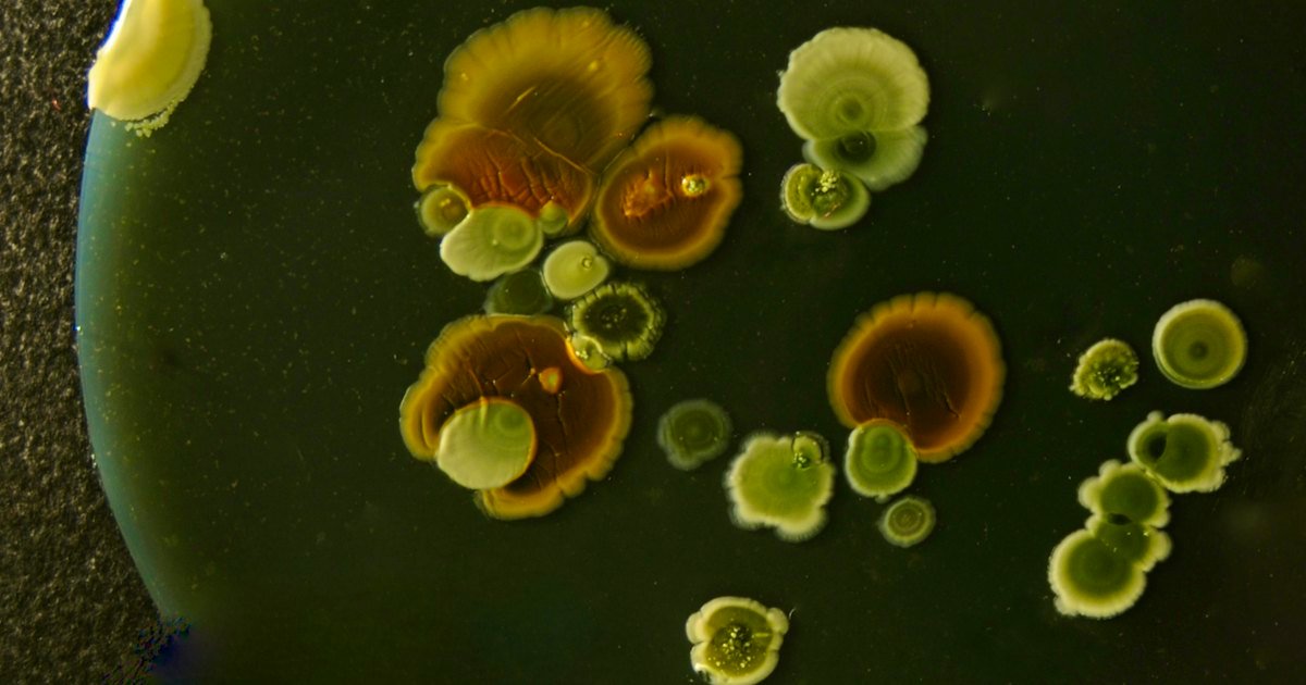 Bacterial colonies growing in a laboratory culture dish